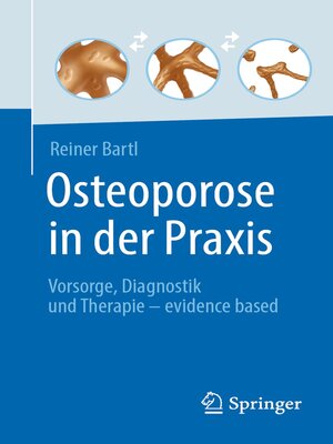 cover image of Osteoporose in der Praxis